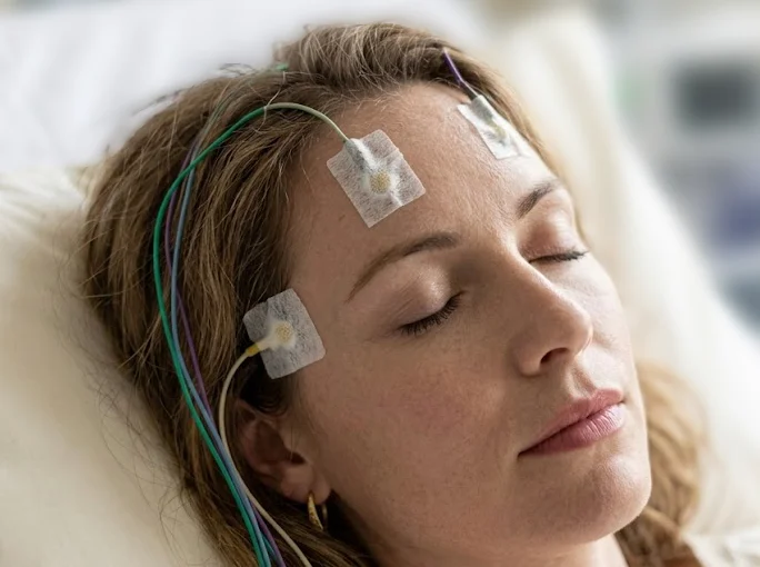 Neurofeedback